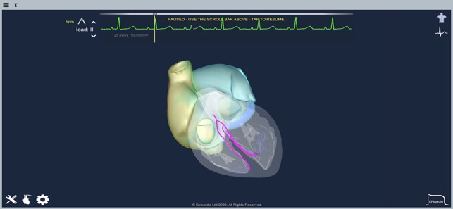 EpicardioHeartSimulatoriPhone版