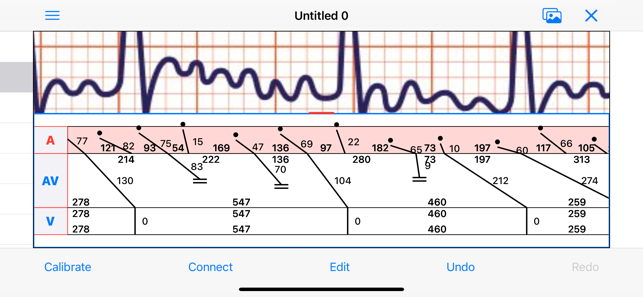 EPDiagramiPhone版