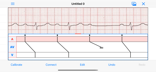 EPDiagramiPhone版