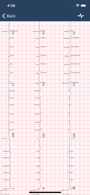 ECGGuideiPhone版