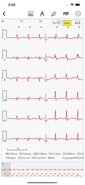 ECGProforDoctorsiPhone版