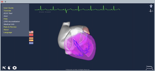 EpicardioHeartSimulatoriPhone版