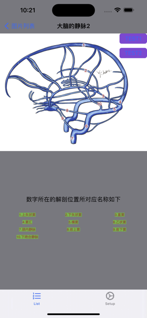 脑血管学习iPhone版