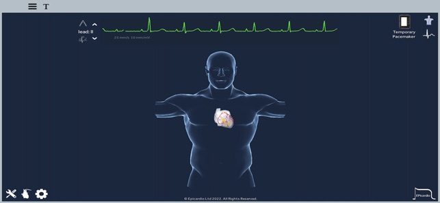 EpicardioHeartSimulatoriPhone版
