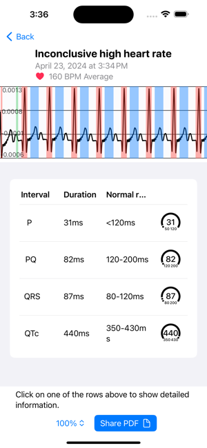 ECG AIiPhone版