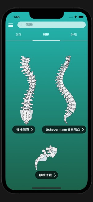 脊柱创伤‬iPhone版