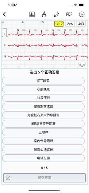 ECGProforDoctorsiPhone版