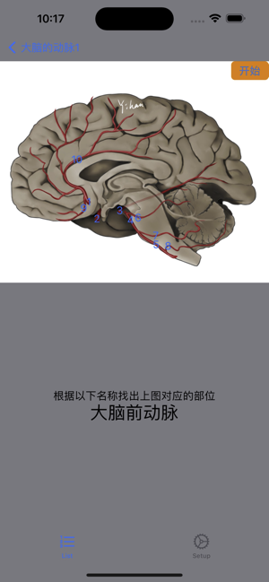 脑血管学习iPhone版