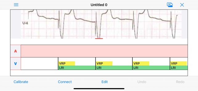 EPDiagramiPhone版