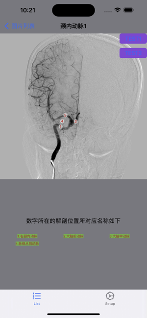 脑血管学习iPhone版