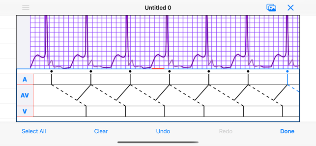 EPDiagramiPhone版