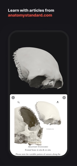 SkulliPhone版