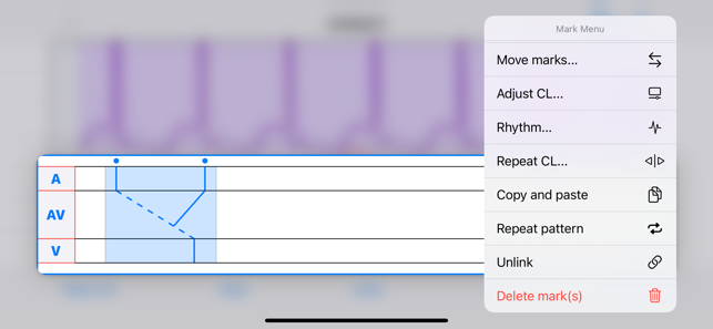 EPDiagramiPhone版