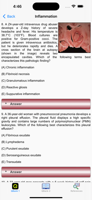 Pathology for the USMLE ExamsiPhone版