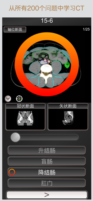 CT护照测验"腹部"/剖面解剖/MRIiPhone版