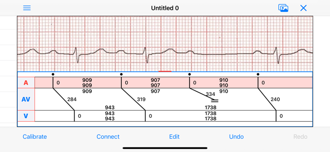 EPDiagramiPhone版