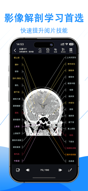 影像解剖圖譜iPhone版