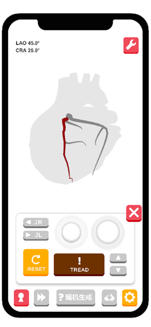 冠脉造影模拟器‬iPhone版