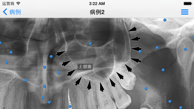 iPanoramiciPhone版