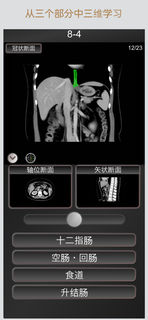 CT护照测验"腹部"/剖面解剖/MRIiPhone版