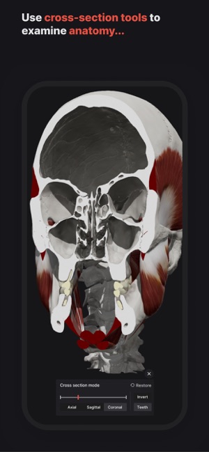 SkulliPhone版