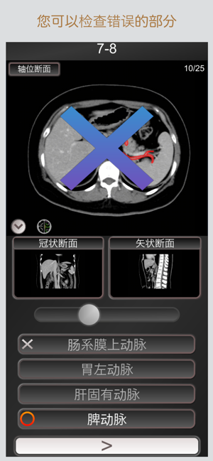 CT護照測驗"腹部"/剖面解剖/MRIiPhone版